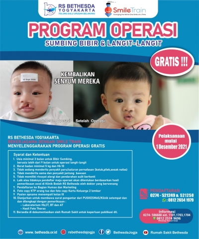 Operasi Bibir sumbing dan Langit-langit Gratis!! di RS Bethesda Yogyakarta bekerjasama dengan Smile Train