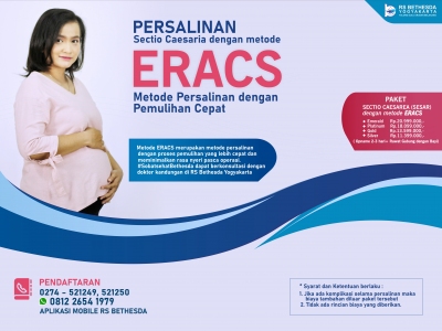 Apa itu Metode Persalianan Eracs? 